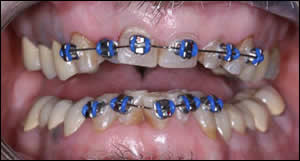 Comprehensive Care Figure 5 Comprehensive Care Figure 5